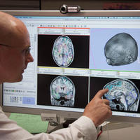 man pointing to part of a human brain on a computer screen 